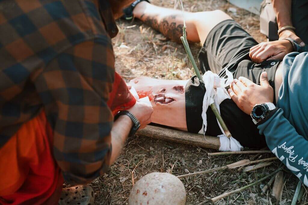 Photo mac jones injury